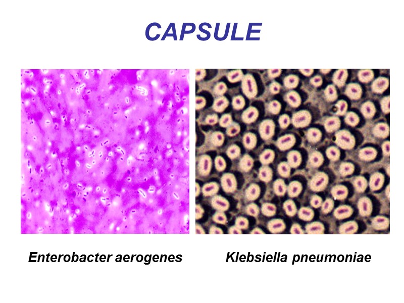 CAPSULE Klebsiella pneumoniae Enterobacter aerogenes
